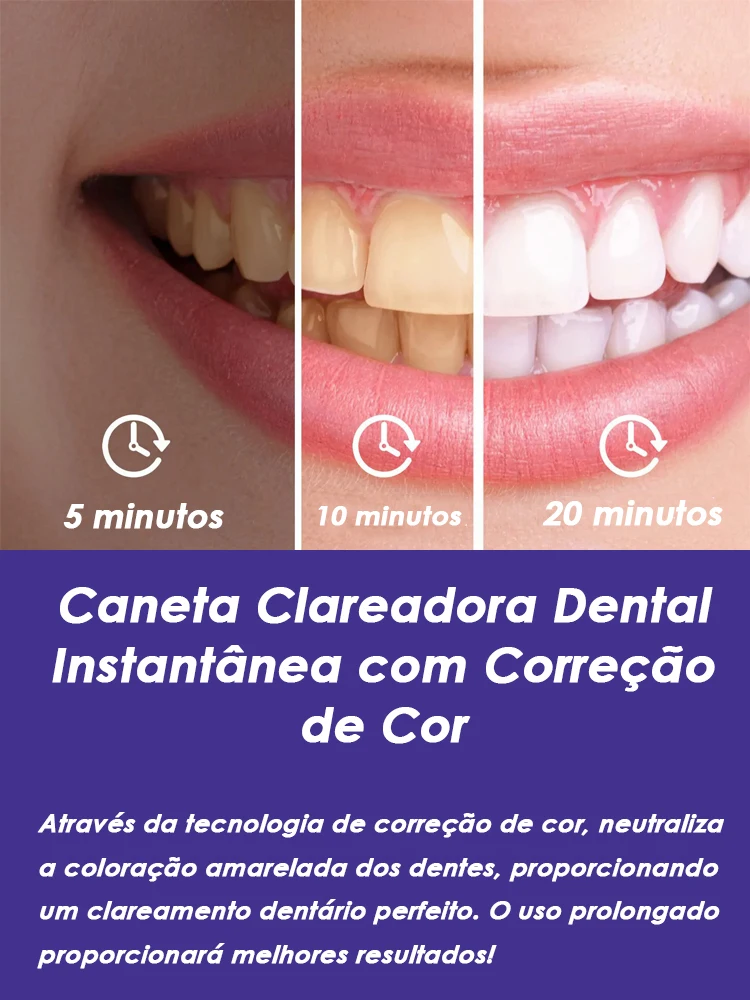 Caneta Clareadora Instantânea Glorysmile V34 para Limpeza de Tártaro e Cuidado com Cáries 2
