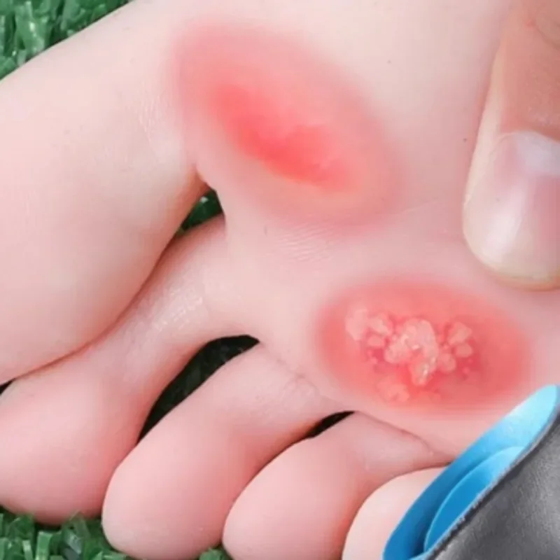 Stretch Cotton Massage Insole 5D Cloud Sensation Relieve Pain Shoe Pad Elastic Sweat Absorbing Insoles Breathable Shoe Cushion