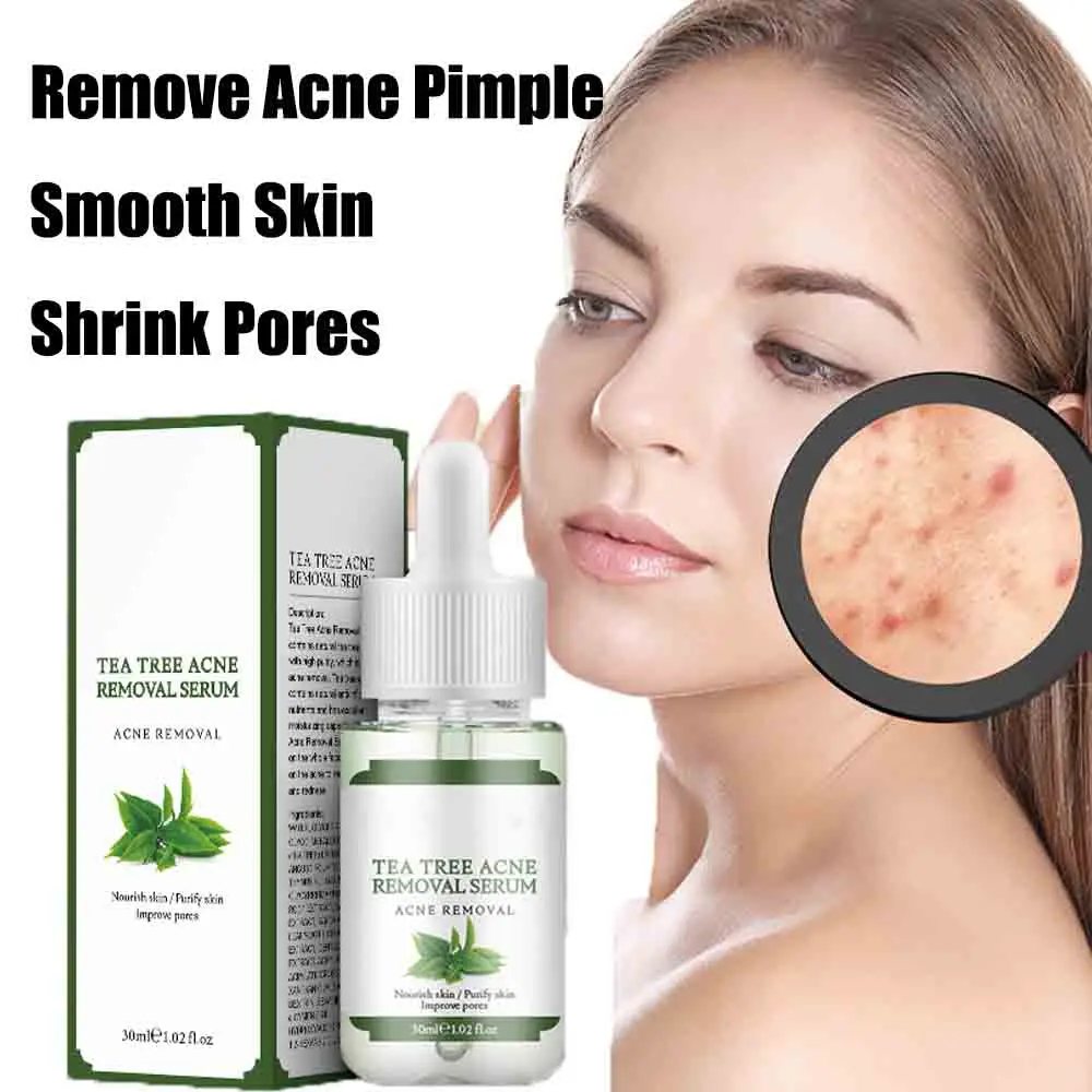 Tea Tree Acne Removing Essence Dilute Acne  Removing Acne Refining Pores Tea Tree Skin Care Essence Stock Solution 15ml sodium chloride physiological saline for tattoo 0 9 topical dilute salt water cleaning solution