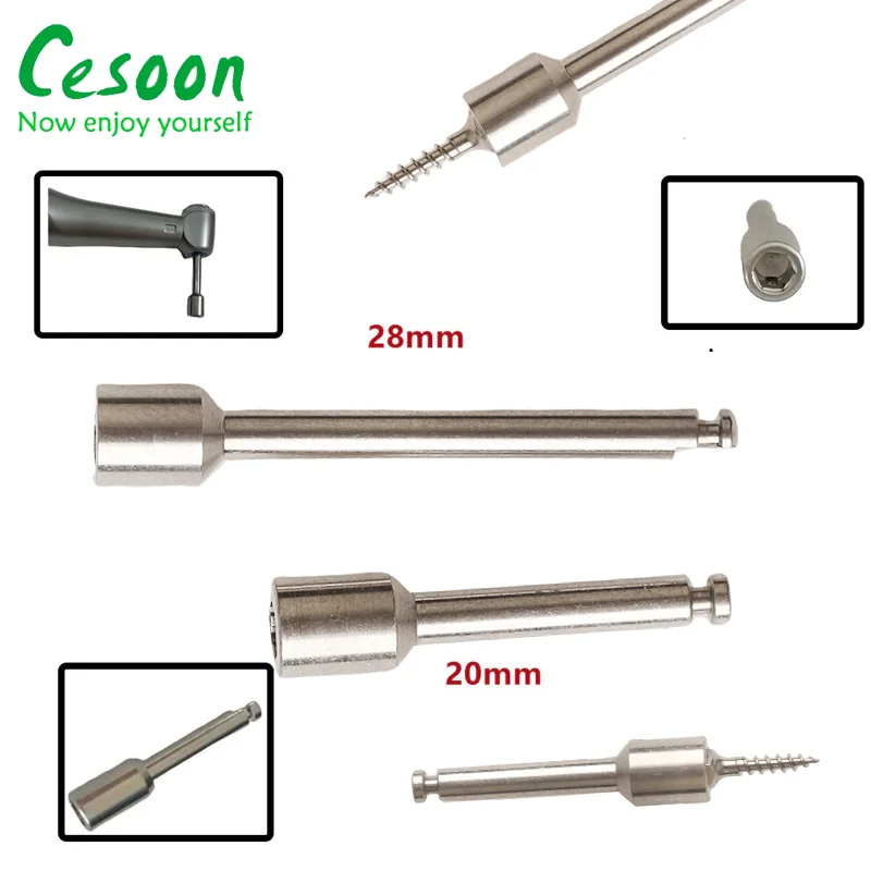 Aazon.co: 10Pcs Orthodontic Ini Iplants Icro Screw +1Pc