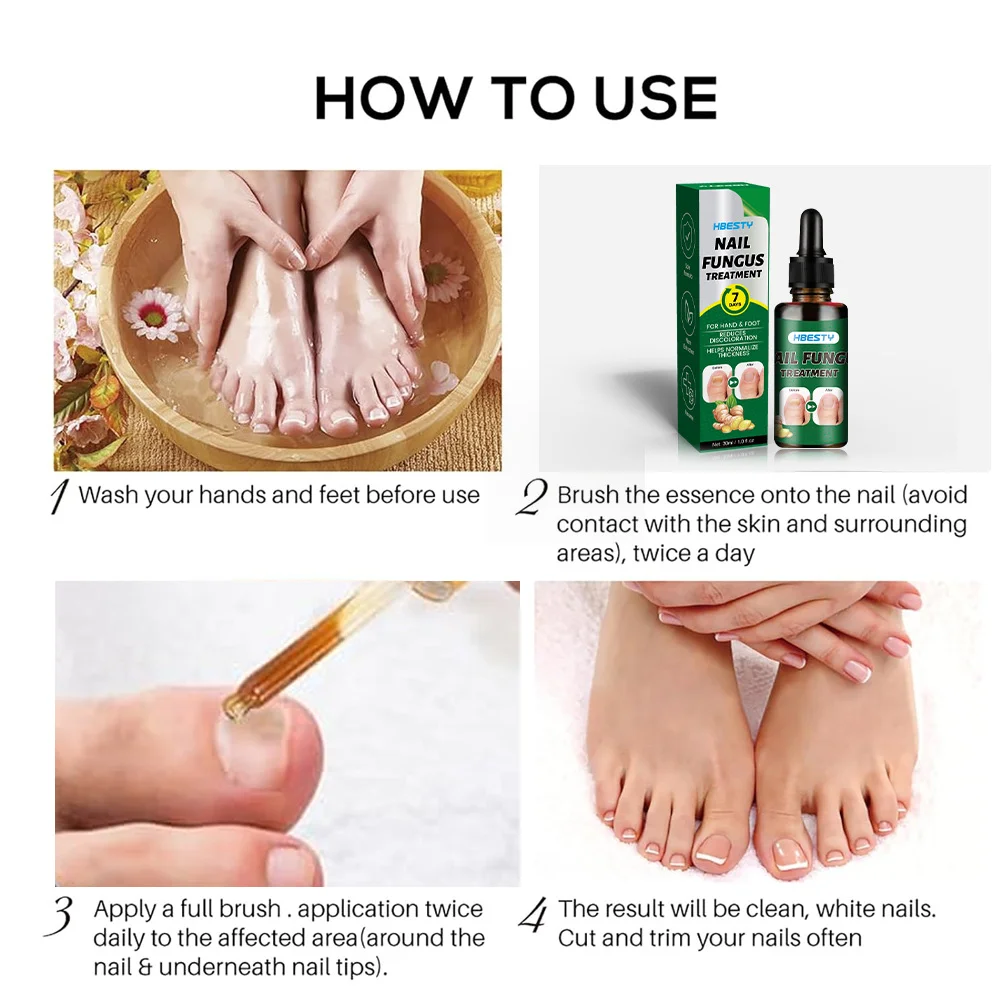 7Days Nail Fungus Treatment Serum Ginger Anti-infective Paronychia Onychomycosis Toe Foot Nail Fungal Repair Gel Hand Foot Care nail fungus treatment