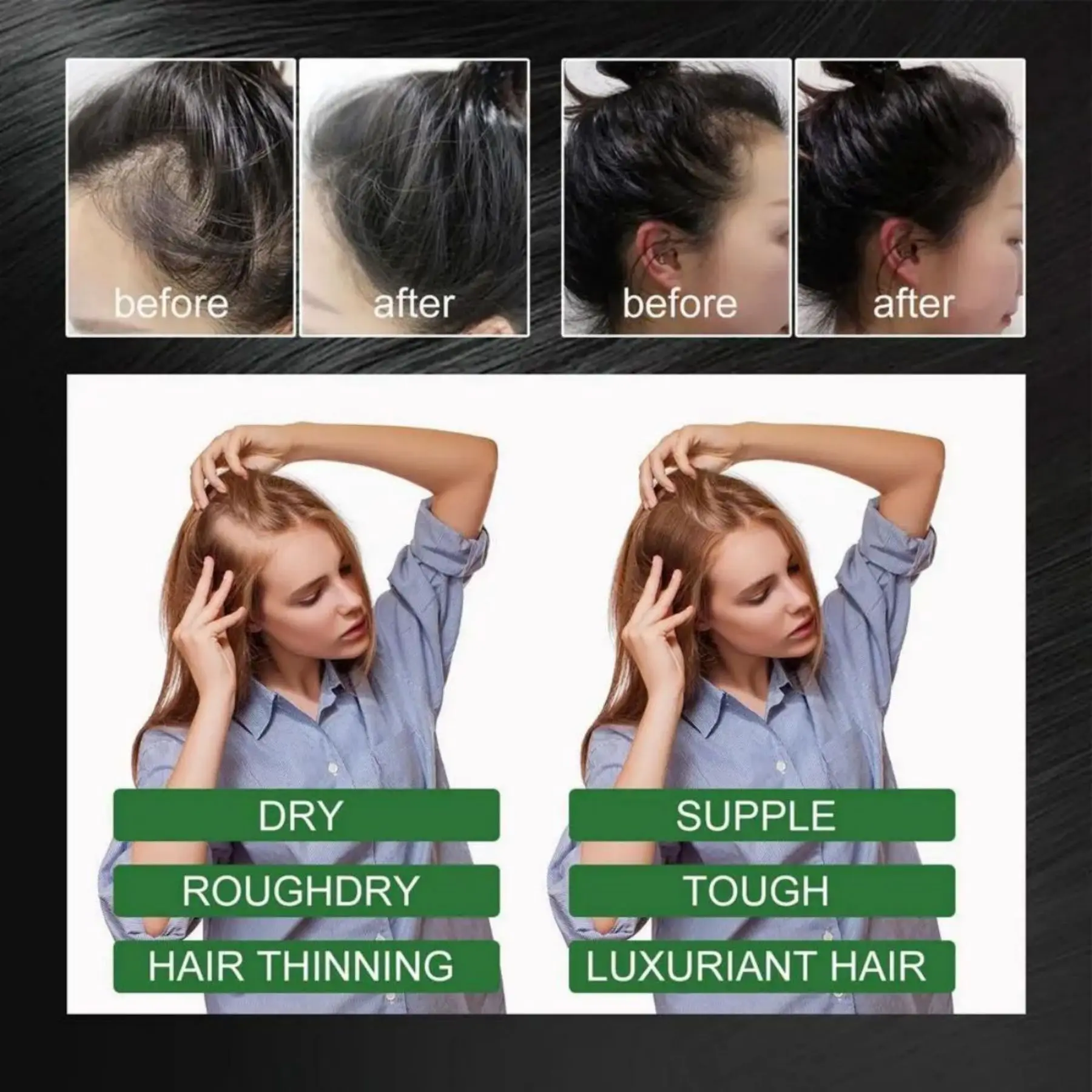 Hair Growth Essential Oil Strengthen Hair Roots Anti Loss Care for Men