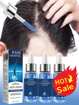 Trattamento contro la perdita dell'olio per la crescita dei capelli Riparazione levigante Prodotti per la crescita dei capelli danneggiati per uomini e donne Cura dei capelli