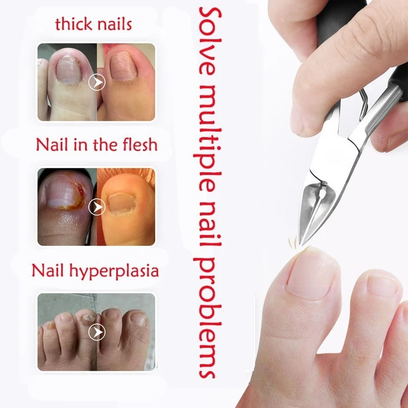 Toe Nail Clippers Stainless Steel Eagle Nose Pliers Nail Correction Pliers Inward Toe Keratin Scissors Edge Trimmer toe nail clipper nail clippers
