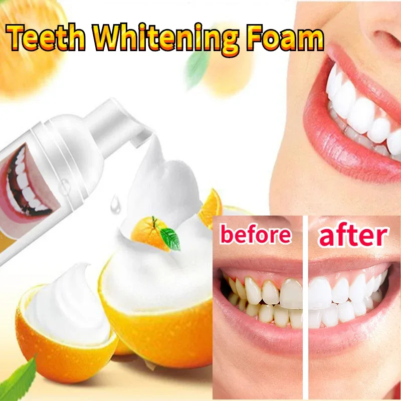 

Teeth Cleansing Whitening Mousse Whitening Teeth Remove Tooth Stains Clean Mouth Fresh Breath Mint Foam Portable Toothpaste 60ml