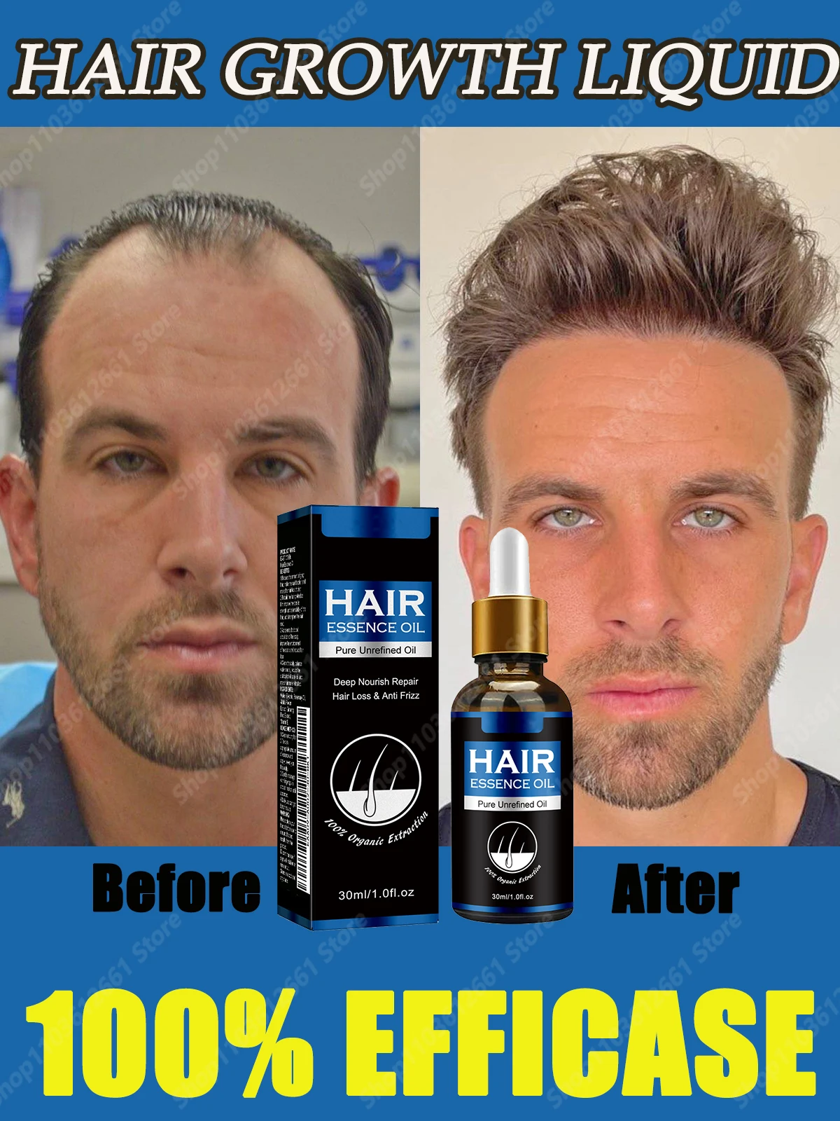 Anti-Hair Loss Treatment Rapid hair growth Liquid Hair Hydrating Growth Nutrient Solution effective hair growth product