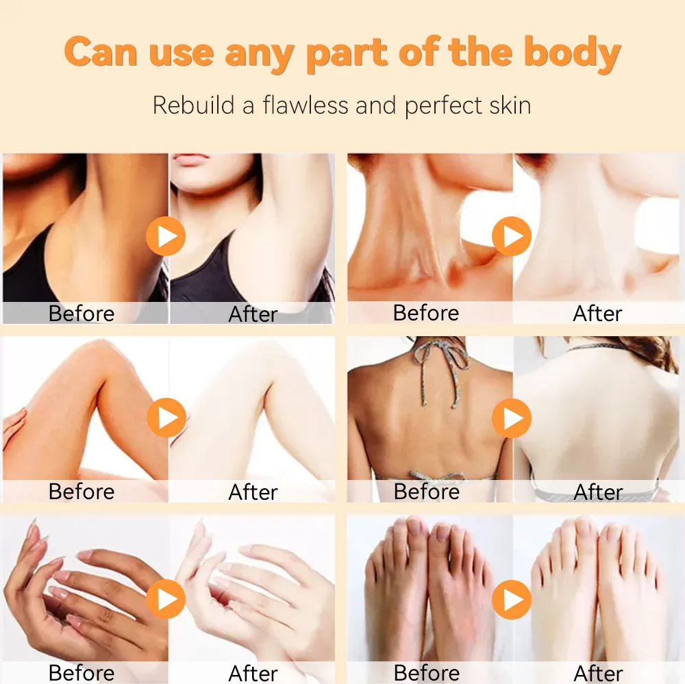 Handmade Kojic Acid Yoni Soap And Oil Body Intimate Whitening Vaginal Itching Odor Relief Ph Balance Anti Infection For Women 5