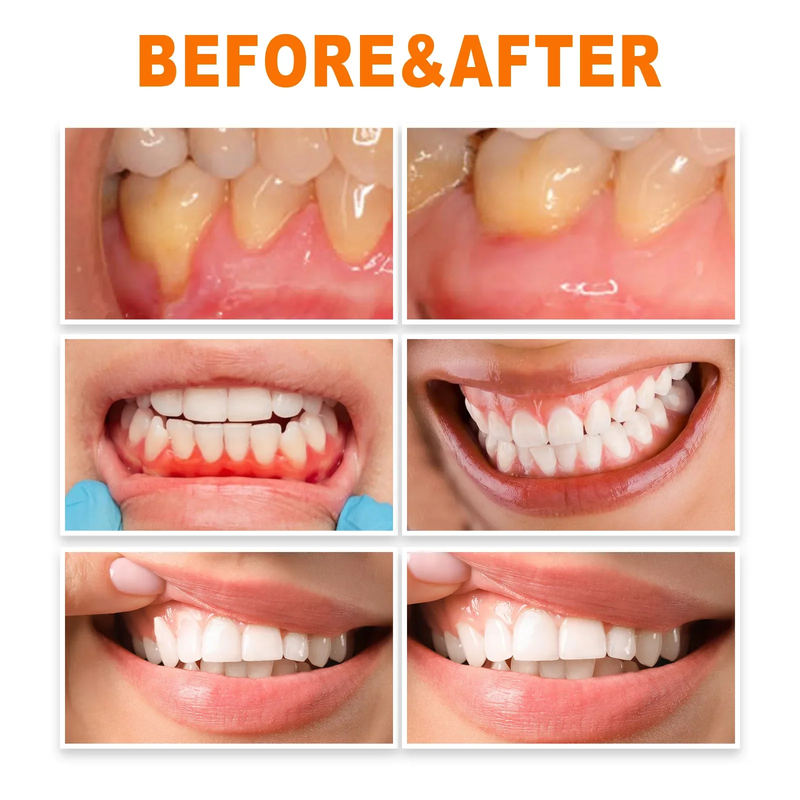 Tooth Gum Serum Repair Anti Gingival Atrophy Recession Inflammation Discomfort Disease Remove Stain Oral Whitening Teeth Essence teeth whitening strips,teeth whitening toothpaste,teeth whitening powder,teeth whitening kit,teeth whitening gel