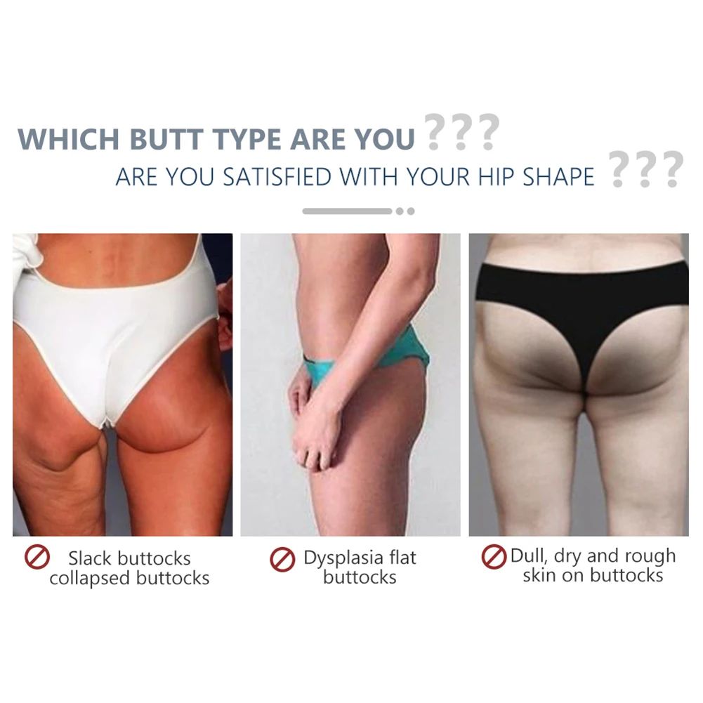 Птоз ягодиц до и после