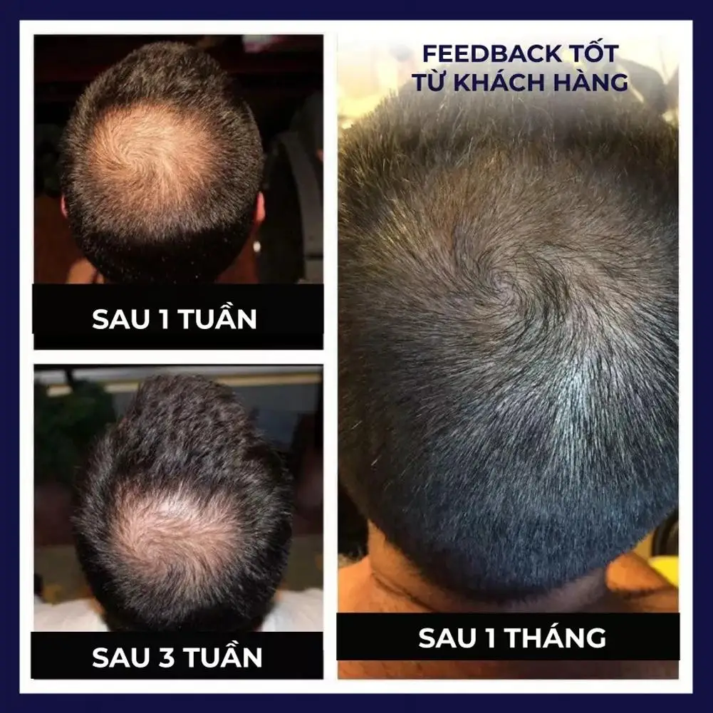 50ml FEG Organic Anti Hair Loss Growth Hair Treatment Oil Nourishment Spray Care hair growth serum hair growth spray hair growth cream