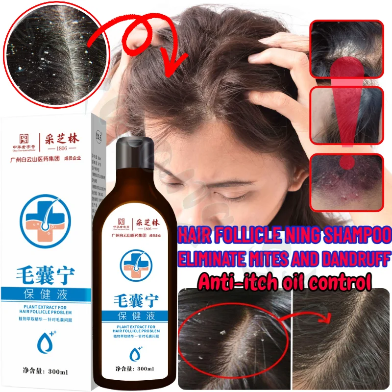 Folliculitis Shampoo Repairs Oily Head, Removes Scalp Mites, Controls Oil, Removes Dandruff, Relieves Itching, Herbal Essence 20ml universal pet ear drops cat and dog ear cleaner for control yeast mites removes ear mites and ear wax relieves itching