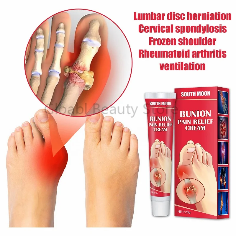

20g Bunion Gout Pain Relief Ointment Toe Joint Valgus Corrector Cream Hallux Knee Lumbar Arthritis Treatment Medical Plaster