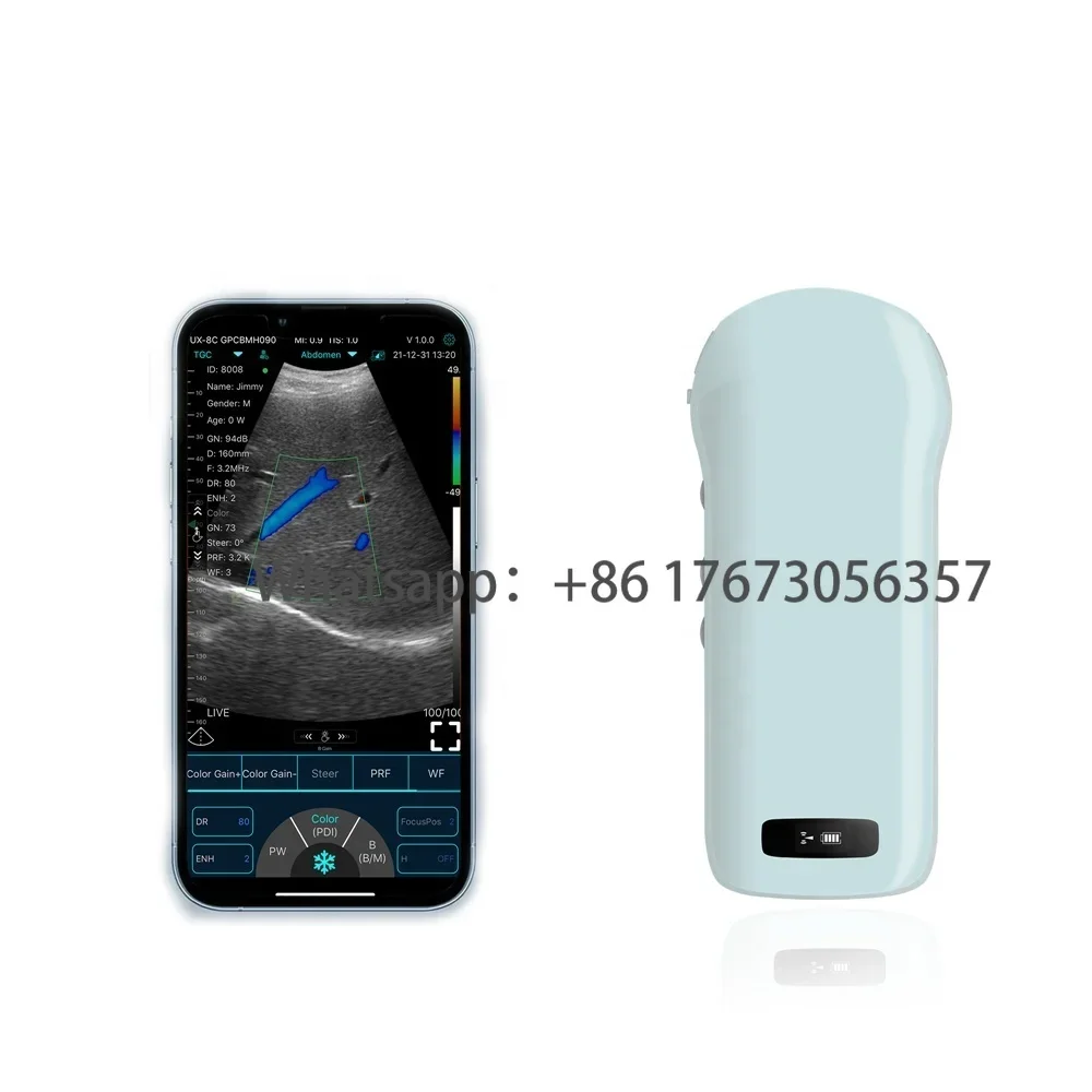 Ecografo Doppler Macchina Ad Ultrasuoni Per Sistema Ospedaliero 4D 5D Ecocardiografia Ecografo Ultrasound