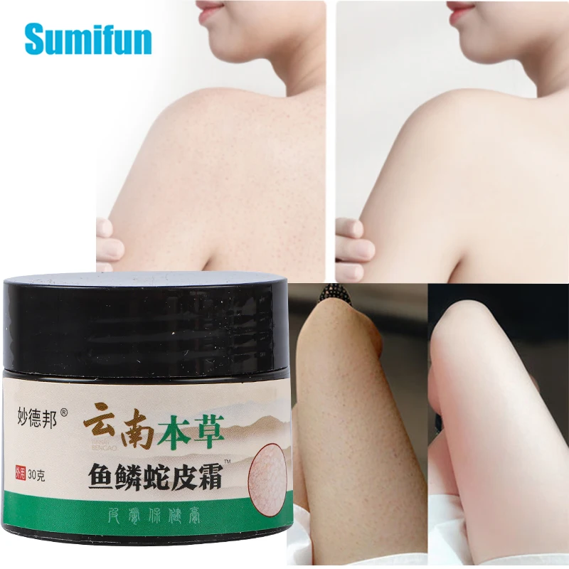 

30g Yunnan Baiyao Keratosis Pilaris/ Kp/ Chicken Skin Treatment Cream Skin Repair Skin Care Essence Moisturizing Nourish Lotion