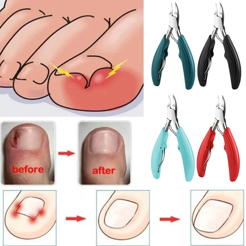 Professional Nail Clipper Ingrown Toenail Podiatry Correction Nippers Cutter Feet Toenail Nipper Tool Paronychia Pedicure Care