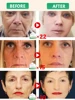 Wrinkles disappear Become beautiful now 3