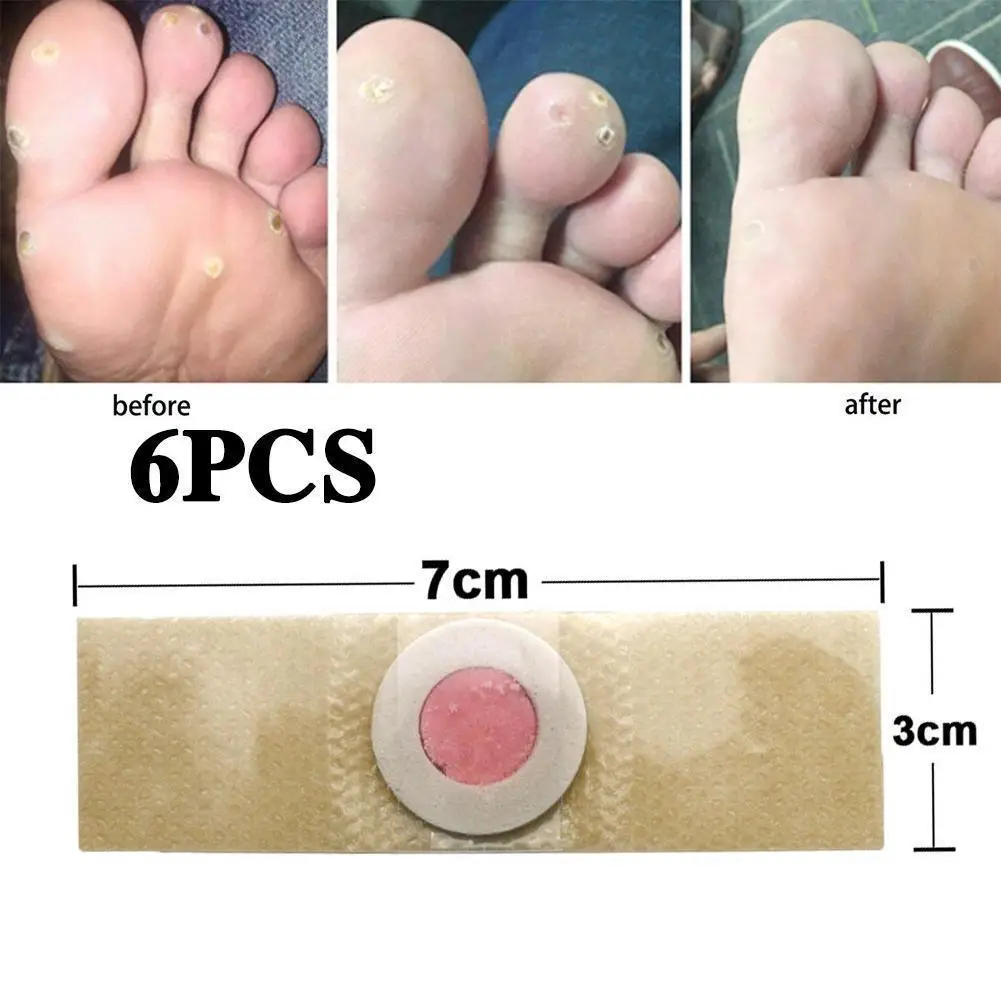 Foot Corn Remover Stickers 6PCS Foot Corn Remover Stickers Painless Medical Plaster Warts Thorn Feet Callus Chicken Eye Treatment Sticker Feet Care
