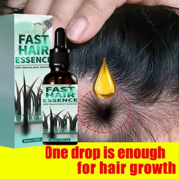 Il trattamento della crescita dei capelli rafforza il cuoio capelluto nutrire il cuoio capelluto leggero non grasso migliora la circolazione del cuoio capelluto