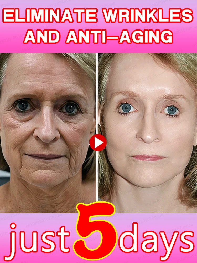 18 years younger. 2