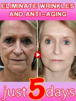18 years younger. 2
