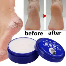 

Chinese Hand Cream Herbs Crack Foot Cream Anti-Drying Heel Cracked Repair Cream Removal Dead Skin Hand Feet Care 4 SIZE