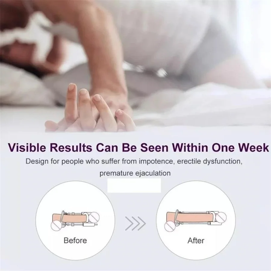 Sex Toys Tools Penis Enlargement Stretch Clamp Extender Penis Stretching Exerciser Growth Traction Device For Men male sex toys