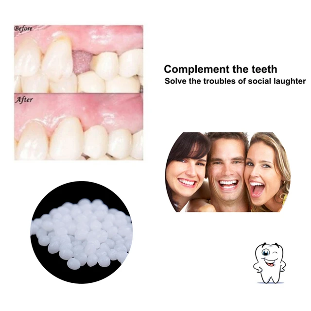 Mojoyce Temporary Tooth Filling Repair False Teeth Solid Glue Dental Repair  Beads 