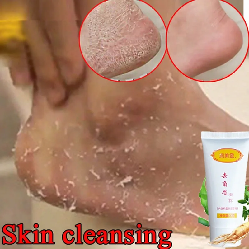 Peeling Gel Facial Exfoliating Peeling Lotion Scrub Deep Clean Acne