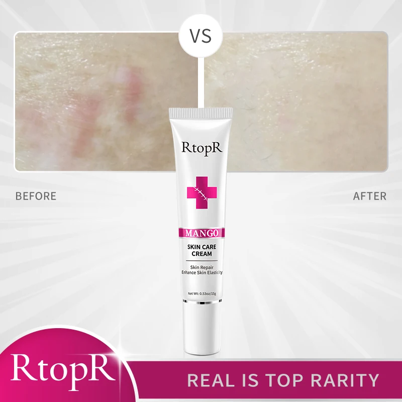 Mango Huidcrème Bleken en Hydrateren Huidverjonging Voedende Huidverzorging_voghion.com