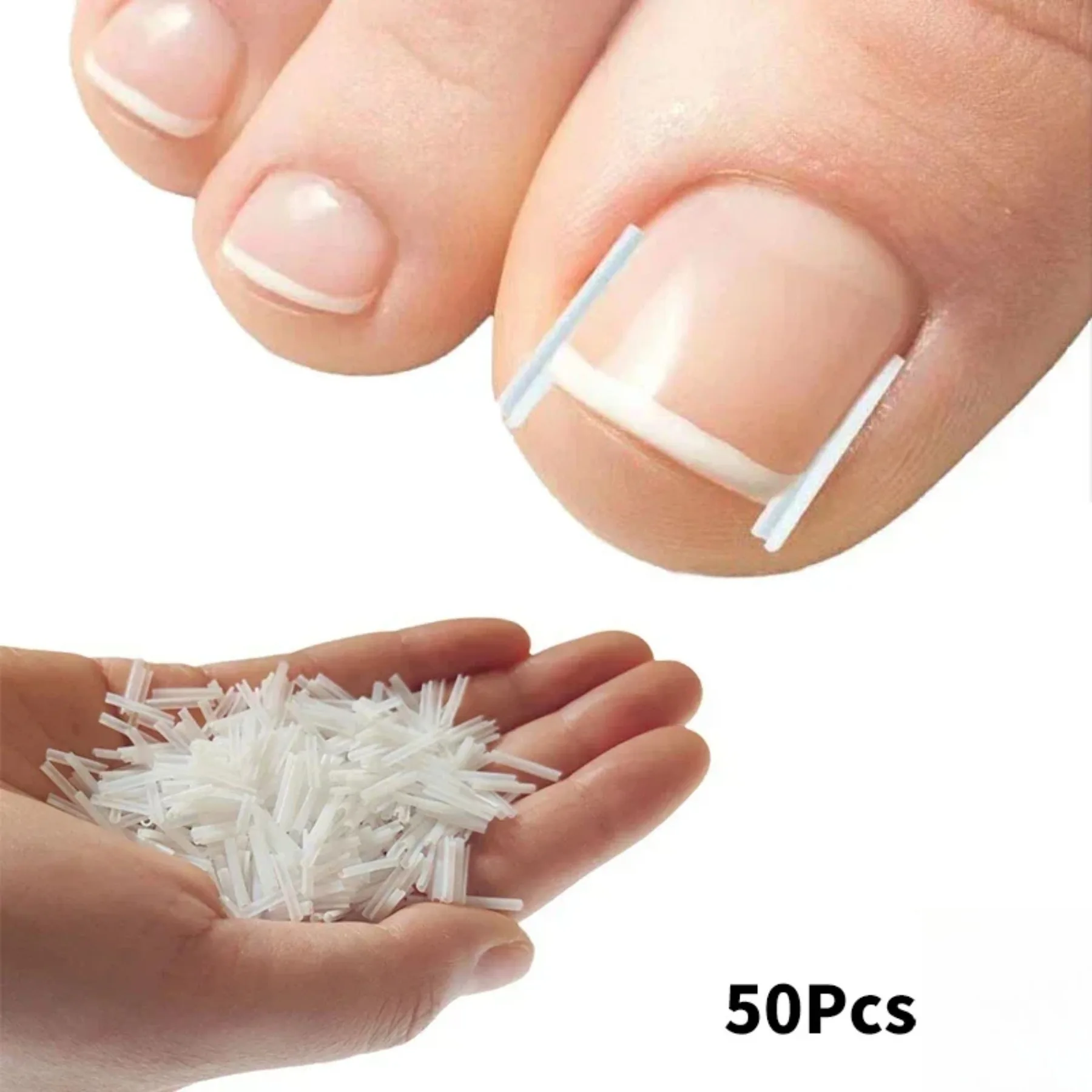 Ingrown Toenail Correction Tool 50Pcs Elastic Patch Sticker Straightening Clip Brace
