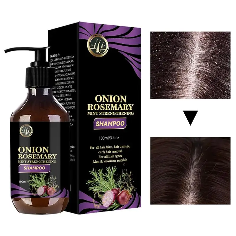 Hair Growth Thickening Shampoo Hair Growth Deep Cleansing Volumizing Shampoo Rosemary Onion Shampoo Hair Thickening Care Product 6