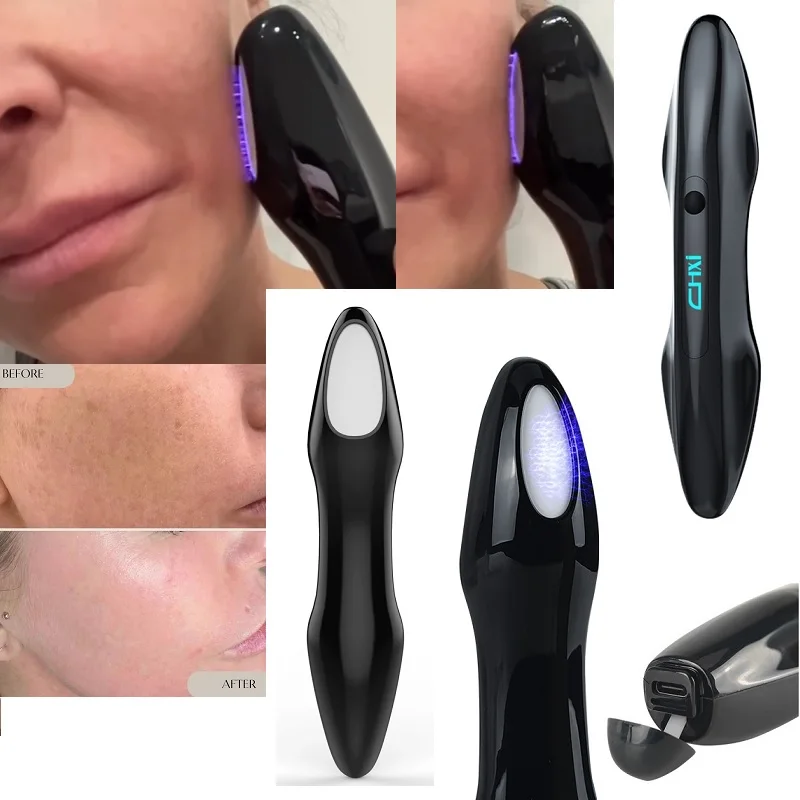 2023 Trending Products Newest Plasma Beauty Equipment Acne Treatment Ozone Plasma Pen