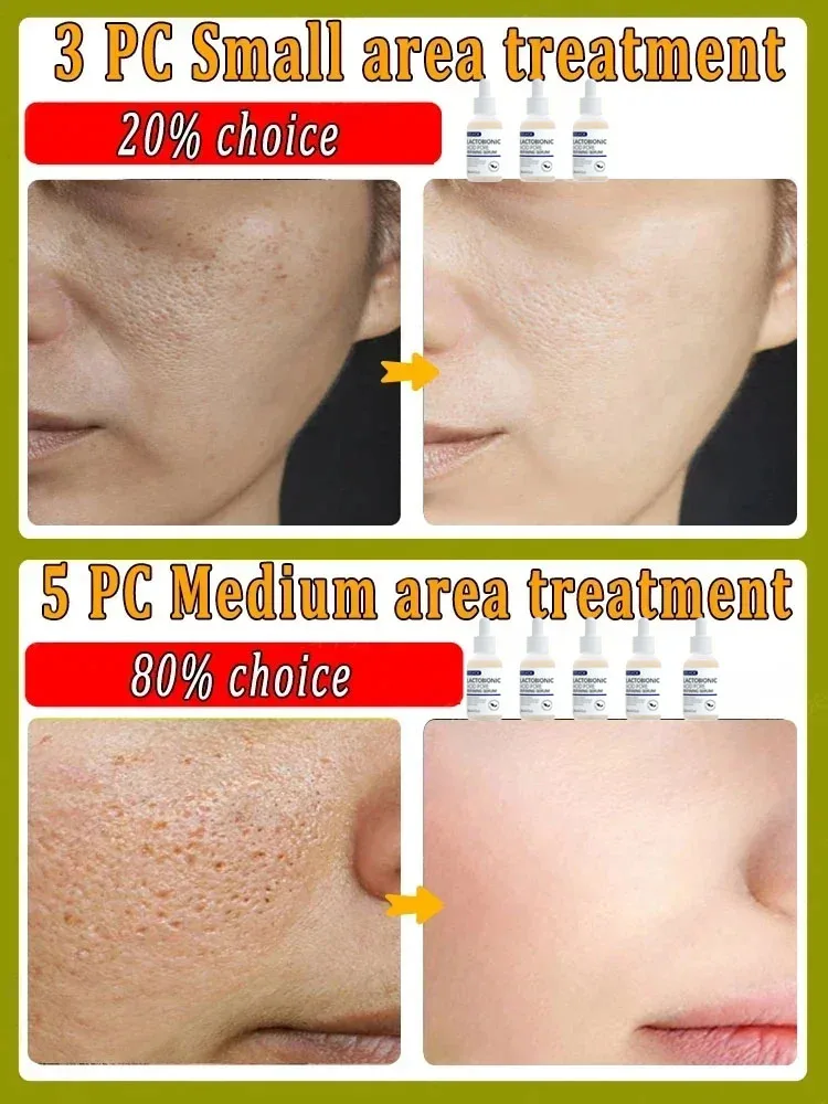 Lactobionic Acid Pore Shrink Face Serum Hyaluronic Acid Moisturizing Nourishing Essence Firming Brighten Beauty Korean Cosmetics 5