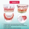 Multiple Types Dental Model Teeth Dental Teaching Models Study Orthodontic Removable Teeth Implant Models Dentist Material 2