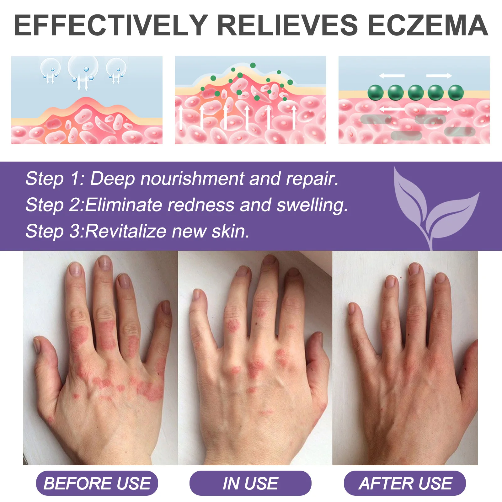 Рисунок 6 - Восстанавливающий крем от псориаза