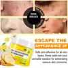 Turmeric Cleansing Pad Kojic Acid Sponges Exfoliating Pads-Acne Scars 50pcs Lemon Chamomile Deep Cleaning For Face Care Products 4