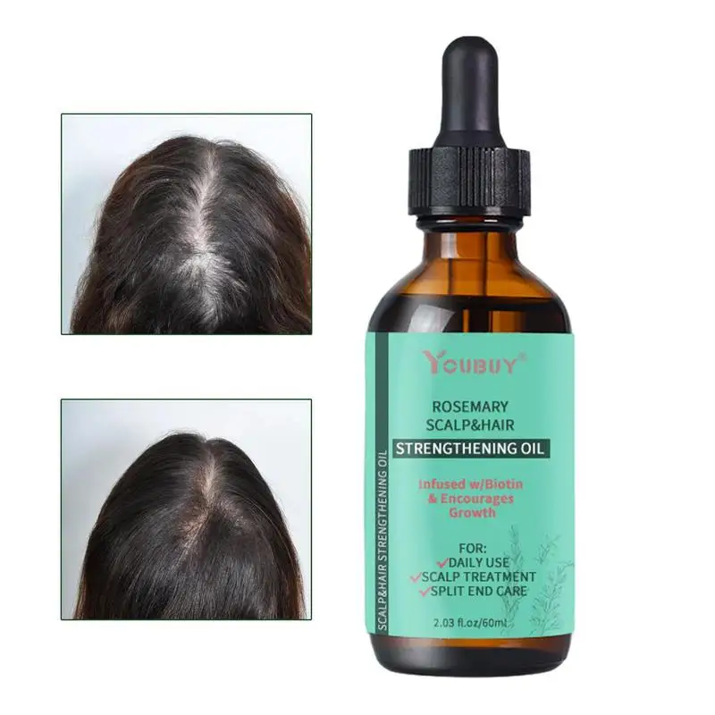 

Rosemary Hair Care Fast Growth Essential Oil Anti-Frizz Loss Smooth Serum Spray Products New Scalp Treatments Hair Care