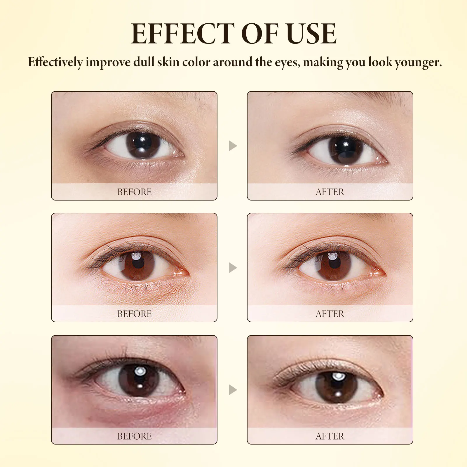 effect of use , Eye Cream with Bee Venom for Firming, Lifting, and Reducing Under Eye Bags