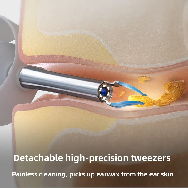 Smart Visual Ear Wax Cleaner with HD Camera Endoscope Wireless WiFi Ear Cleaning Tool for Home Use Ear Wax Remover