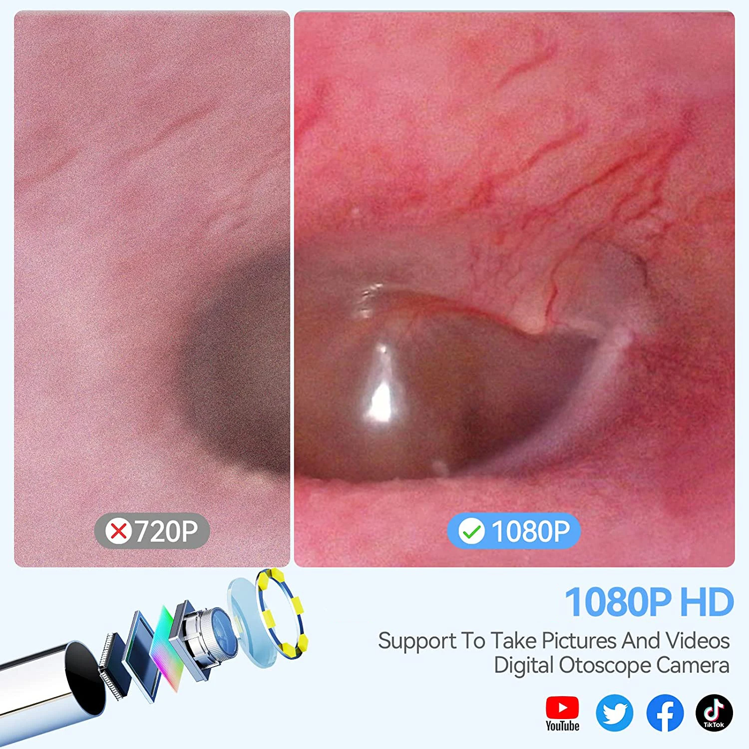 4.5 Inch IPS Color Screen Digital Otoscope 1.0MP 1080P HD 3.9mm Lens Ear Inspection Camera 6 LEDs IP67 3