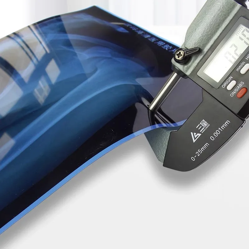 CT 이미징 인쇄용 블루 잉크젯 투명 인쇄 의료 필름, 8*10 인치 크기 도매