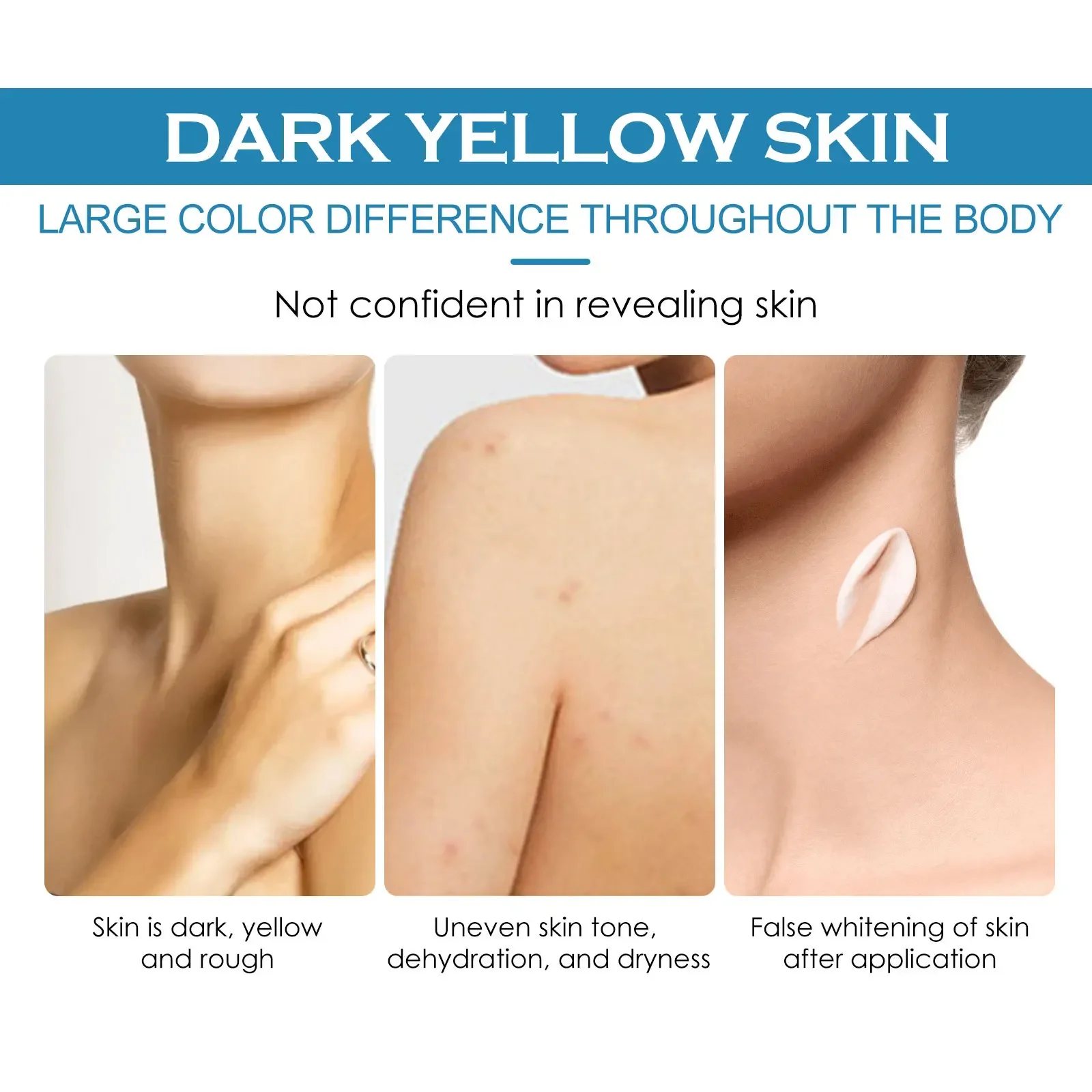 Aufhellende Körperlotion, entfernt Melanin, hellt raue, gelbe, trockene Haut auf, macht sie glatt, befeuchtet dunkle Flecken und erhellt die Arme._voghion.com