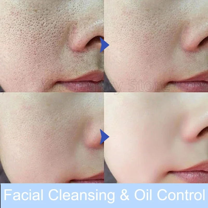 Facial Cleanser Facial Foam Cleanser Gentle Cleansing Pores Oil Control Blackhead Removal Whitening Moisturizing Korean Skin Care Products 80g