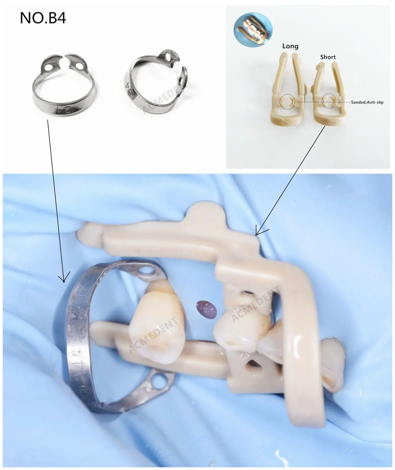 DentalClampRubberDamClampsB4DistalExtentionClipSundriesMolar