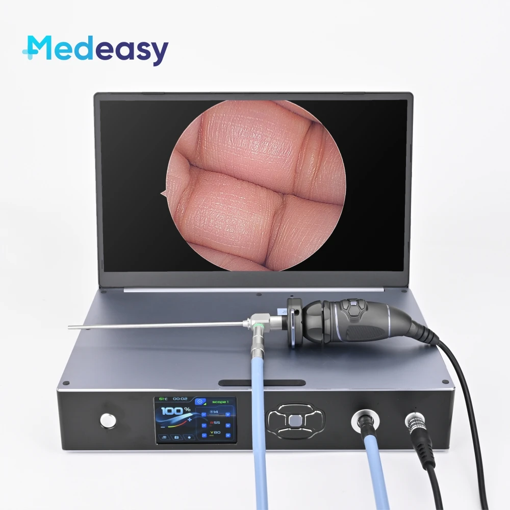 Endoscope Camera Unit Full HD 1080P with 15.6 Inch Medical Screen and 100W Led Cold Light Source