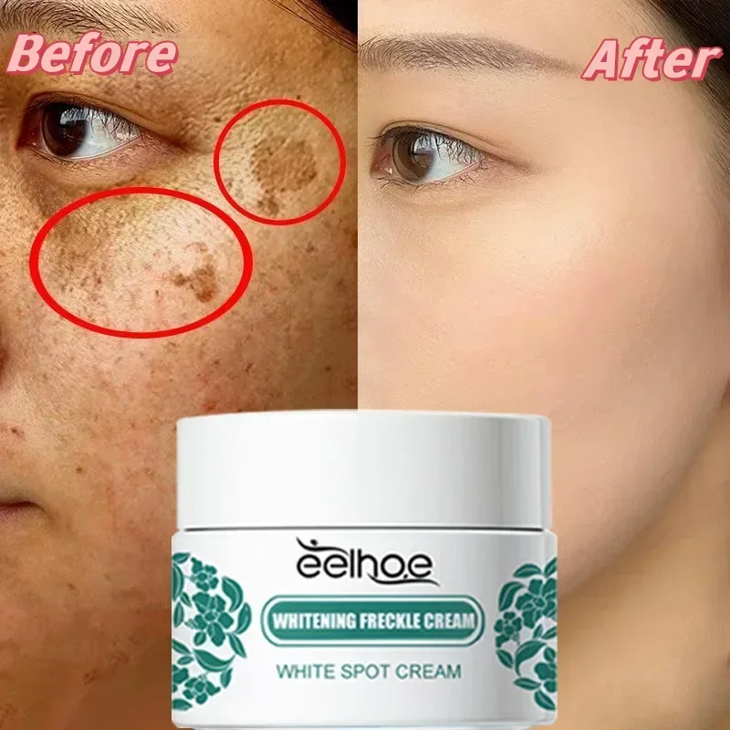 Face Brightening Cream Eelhoe Niacinamide Melasma Brightening Cream Reduce Melanin Brighten Cream Lighten Dark Skin Chloasma Serum Fade Fine Face Lines
