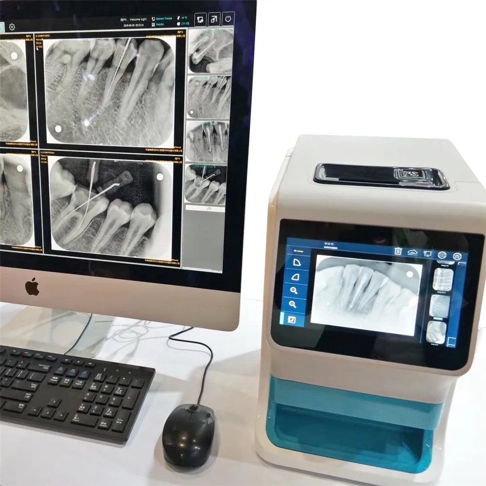 dental imaging phosphor plate scanner digital imaging plate scanner