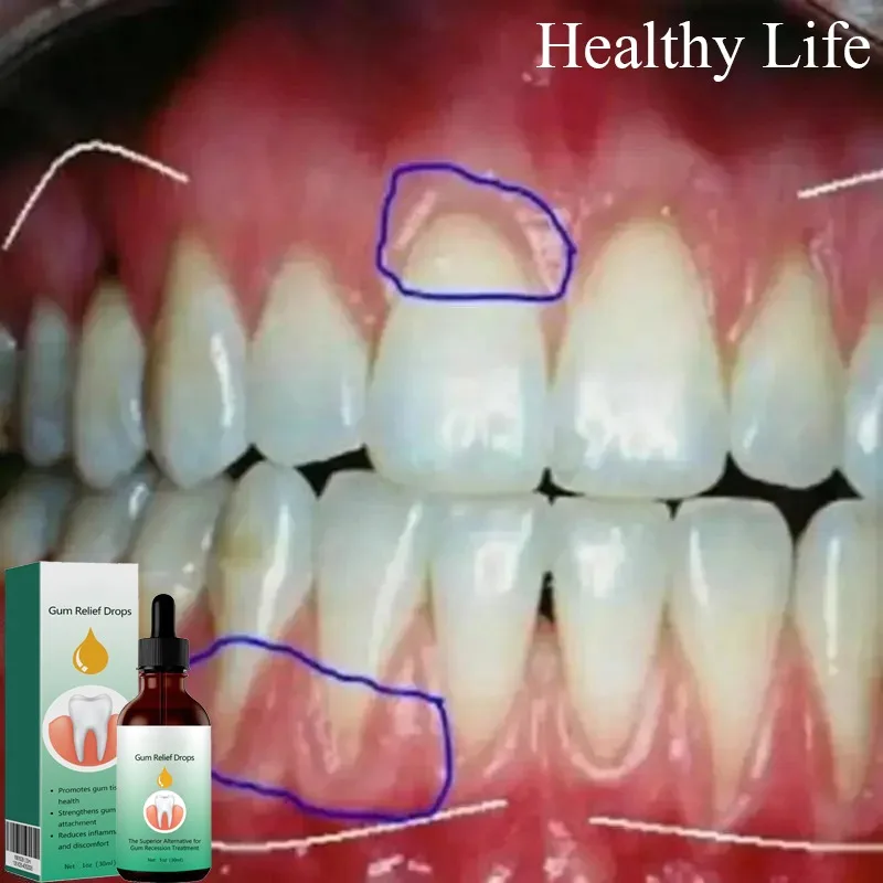 

Gingival Quickly Repair Serum Cavities Teeth Clean Toothpaste Relieve Gums Pain Whiten Tooth Essence Remove Yellow Plaque Stains