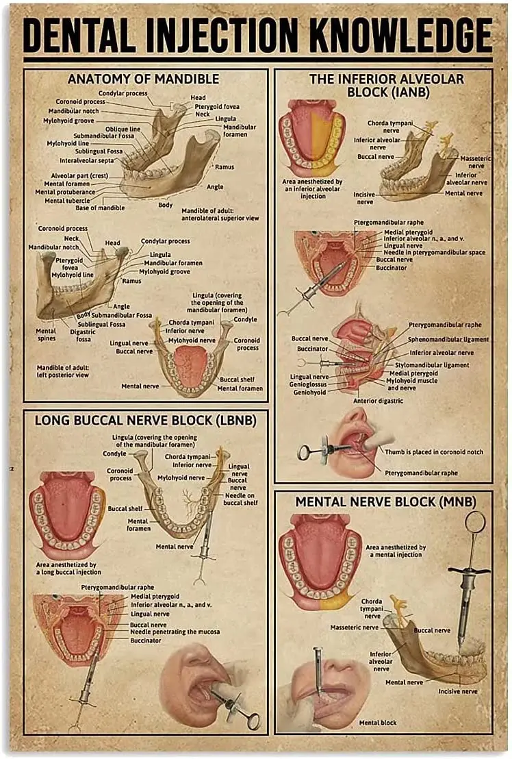 

Dental Injection Knowledge Metal Tin Signs Anatomy Of Mandible Printing Poster Barbershop Bedroom Bathroom School Shop