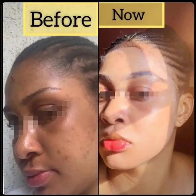 Рисунок 4 - Отбеливающее мыло для тела